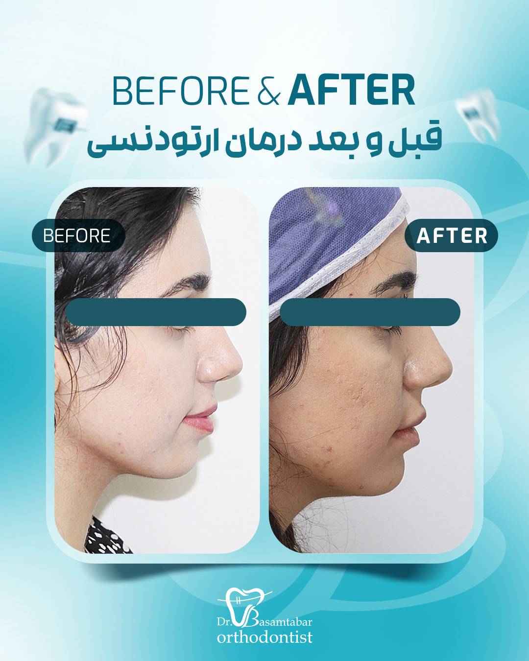 Maryam-BL (2)